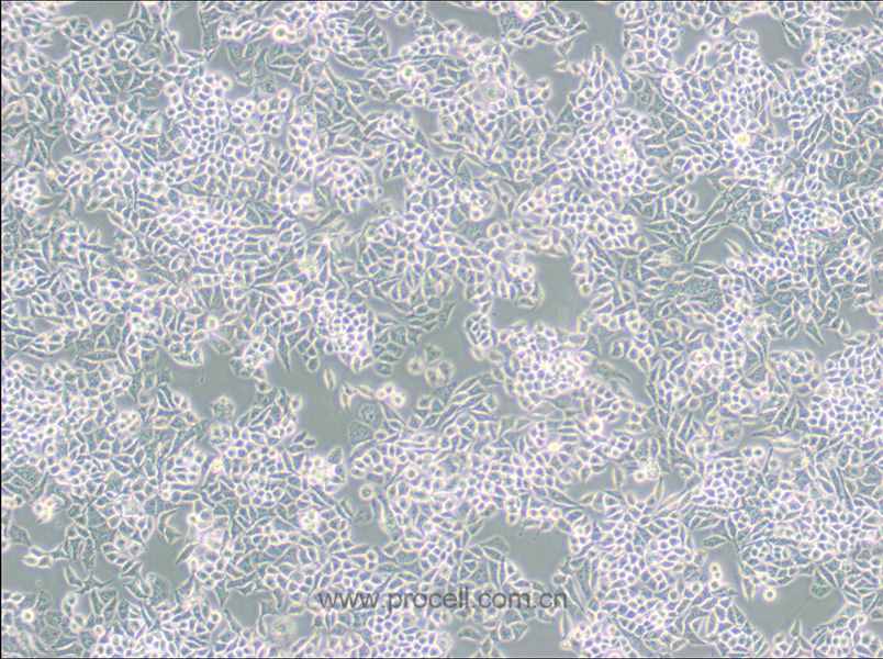 AN3 CA (人子宫内膜腺癌细胞) (STR鉴定正确)