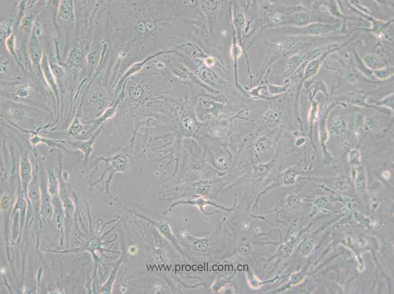 bEnd.3 [BEND3] (小鼠脑微血管内皮细胞) (种属鉴定正确)