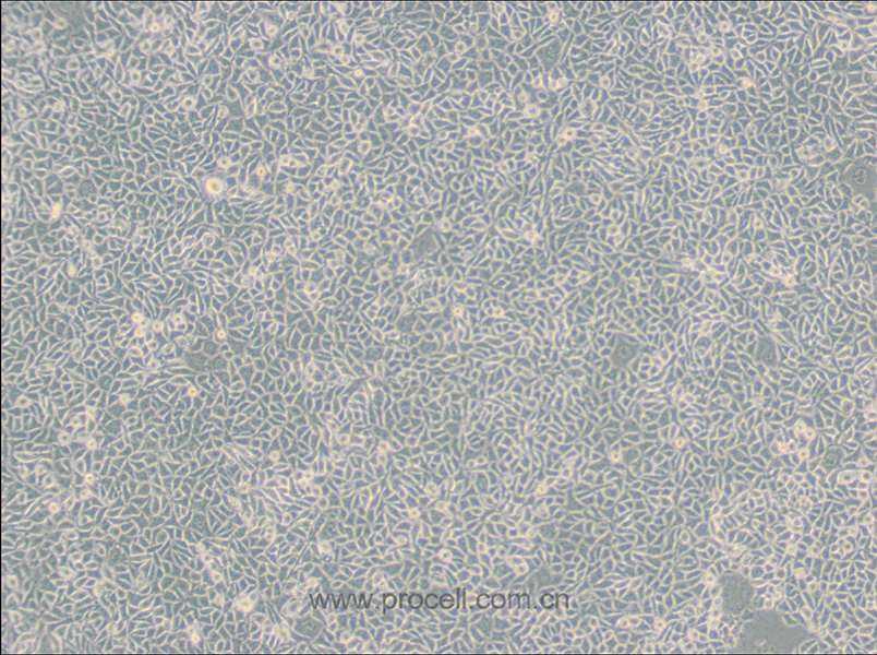 B82 (小鼠肿瘤细胞系) (种属鉴定正确)