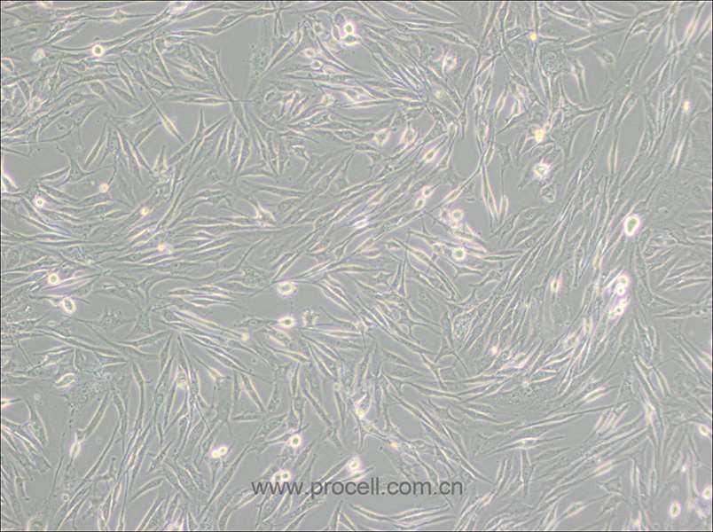 8305C (人甲状腺癌细胞(未分化)) (STR鉴定正确)
