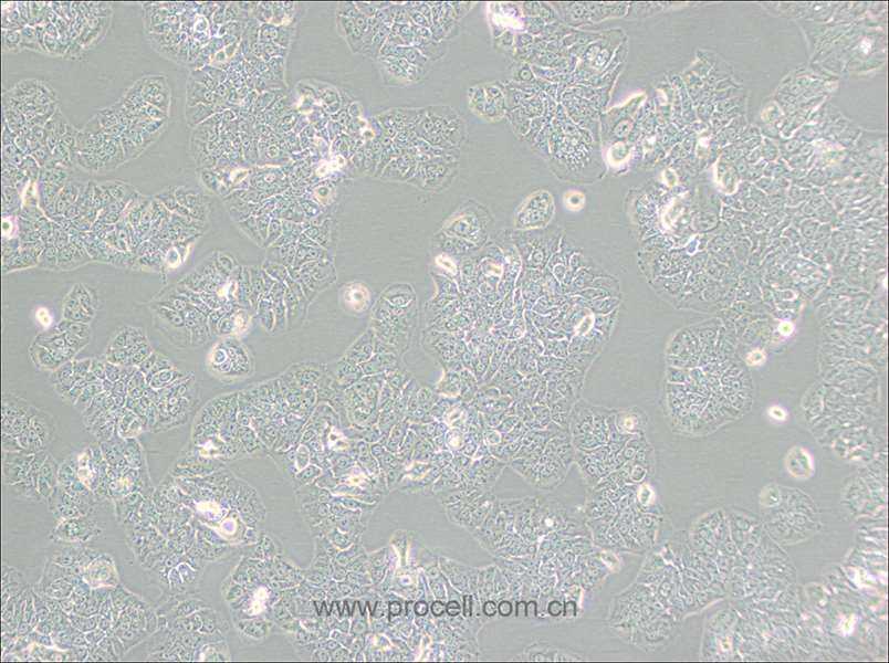 NCI-H1437 (人肺癌细胞) (STR鉴定正确)