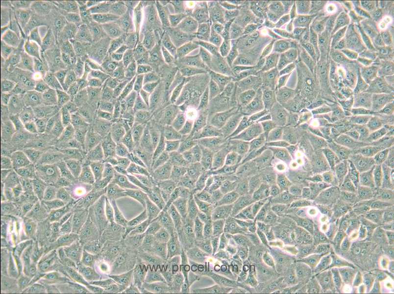 9L/lacZ (大鼠胶质肉瘤细胞) (种属鉴定正确)