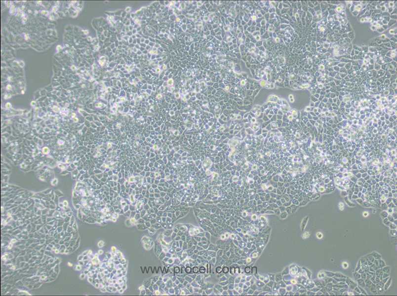 CX-1 (人结肠癌细胞) (STR鉴定正确)