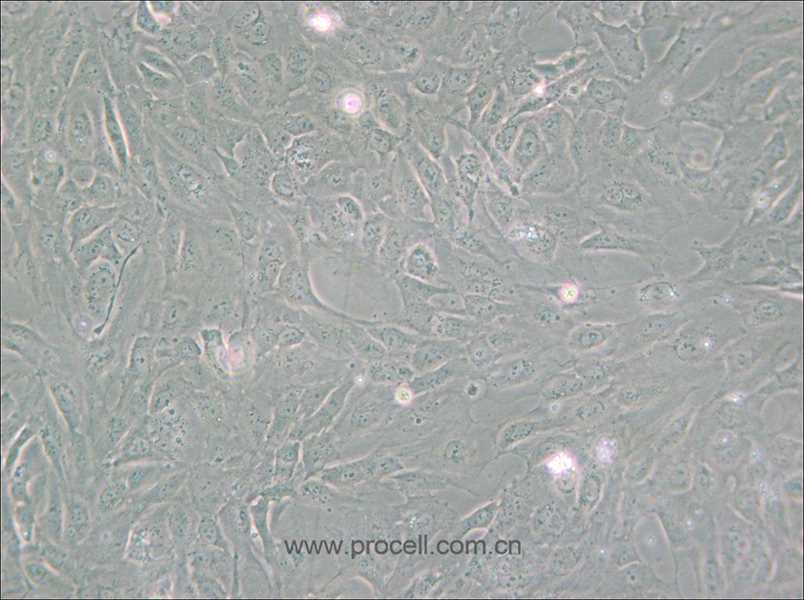PUMC-HUVEC-T1 (SV40T转化人脐静脉内皮细胞) (STR鉴定正确)