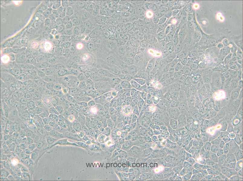 Capan-2 (人胰腺癌细胞) (STR鉴定正确)