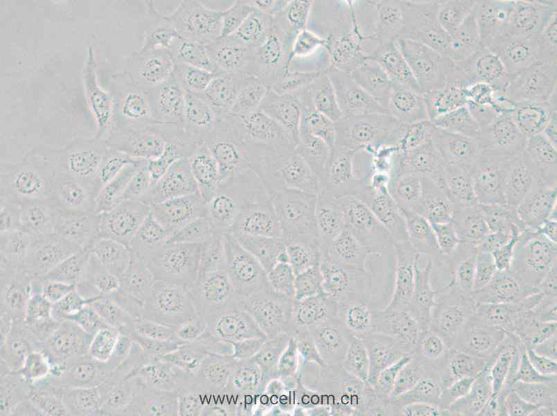 HCE-T (人角膜上皮细胞) (STR鉴定正确)