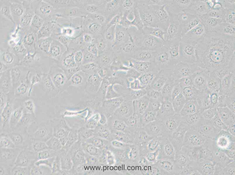 HCE-T (人角膜上皮细胞) (STR鉴定正确)