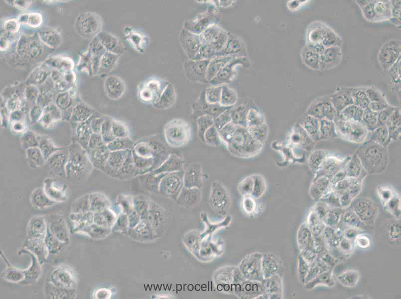 HCC1428 (人乳腺腺癌细胞) (STR鉴定正确)