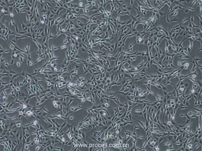 B104 (大鼠神经母细胞瘤细胞) (种属鉴定正确)