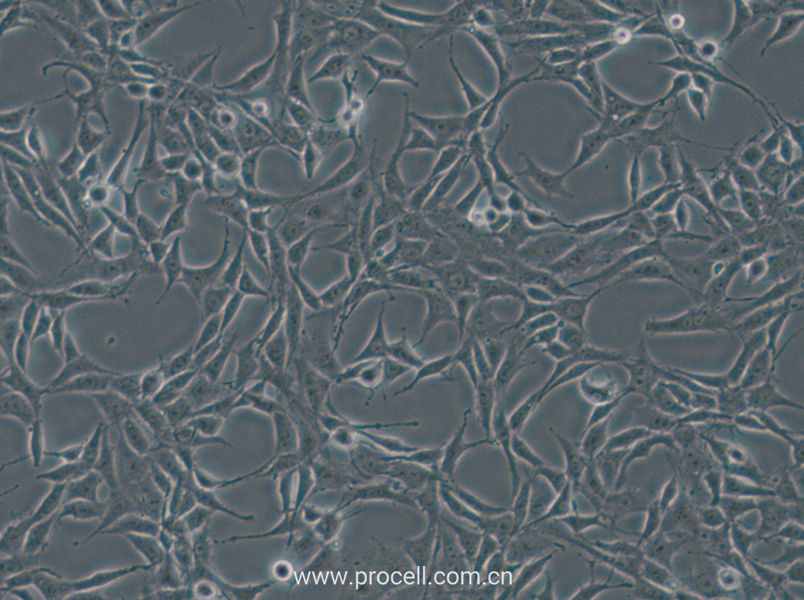 B104 (大鼠神经母细胞瘤细胞) (种属鉴定正确)