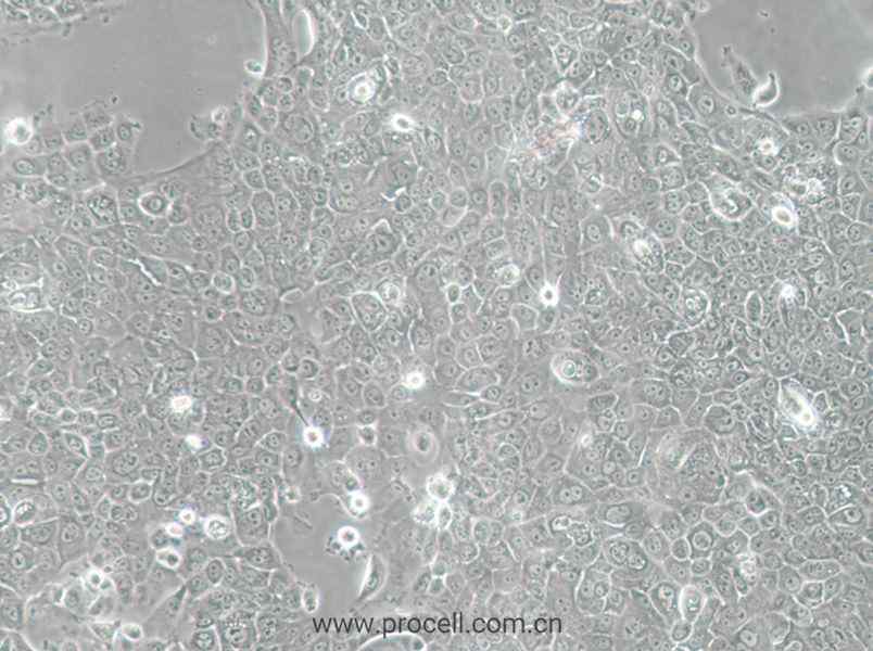 MCF-12A (人乳腺上皮细胞) (STR鉴定正确)