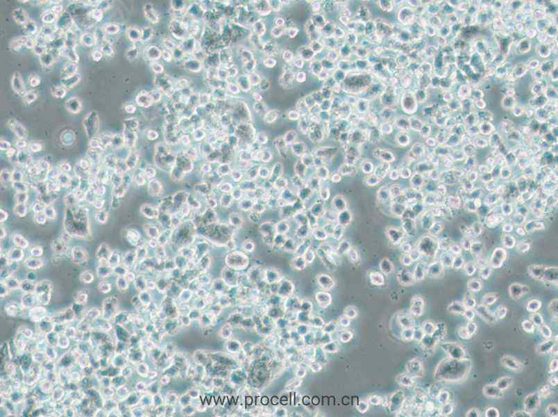 KMS-11 (人多发性骨髓瘤克隆细胞)  (STR鉴定正确)