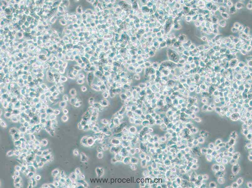 KMS-11 (人多发性骨髓瘤克隆细胞)  (STR鉴定正确)