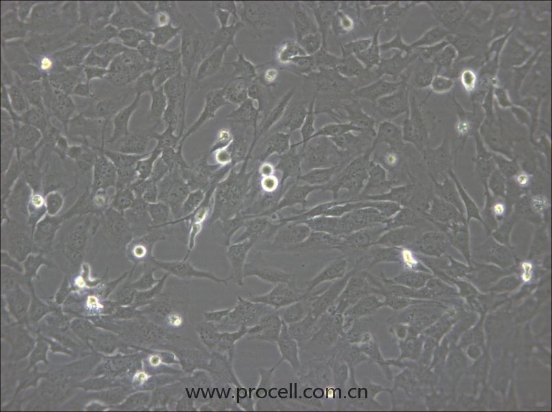 hCMEC/D3 (人脑微血管内皮细胞) (STR鉴定正确)