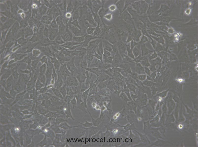 hCMEC/D3 (人脑微血管内皮细胞) (STR鉴定正确)