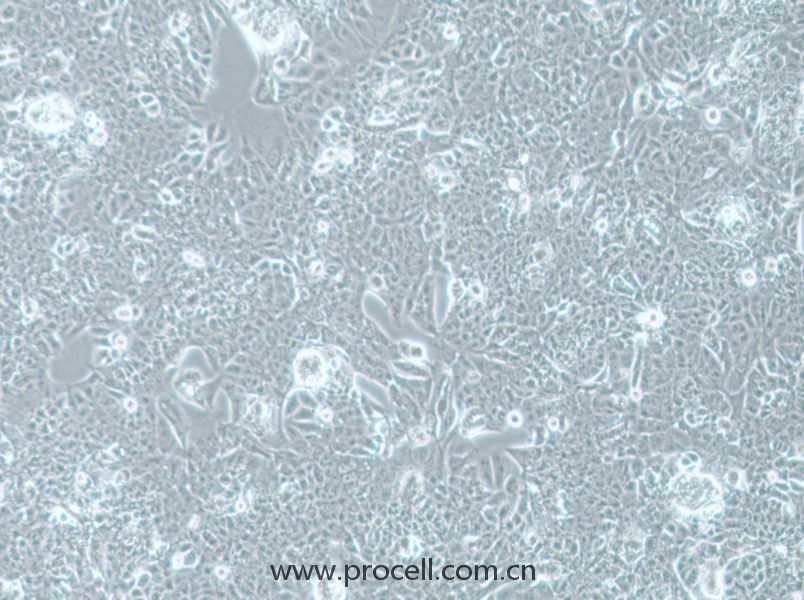 NCI-H1793 (人肺癌细胞) (STR鉴定正确)