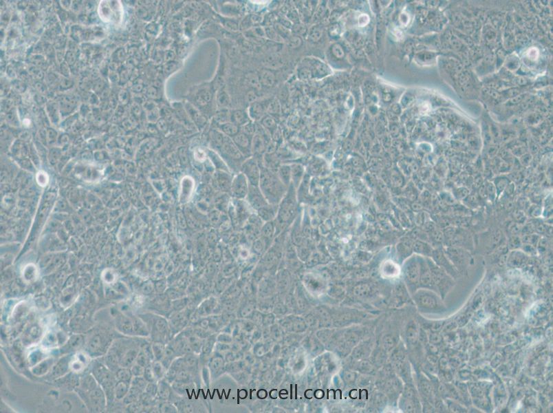 NCI-H1793 (人肺癌细胞) (STR鉴定正确)