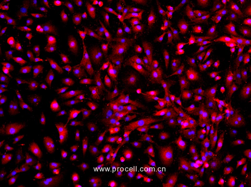 小鼠肺微血管内皮细胞