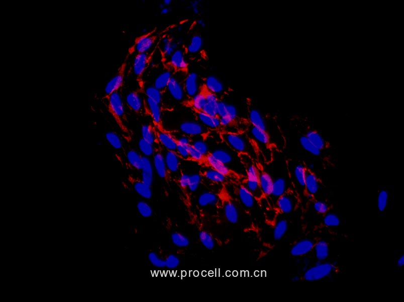 小鼠冠状动脉内皮细胞