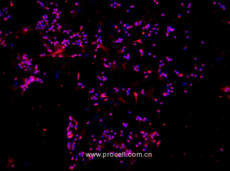 小鼠视网膜神经节细胞