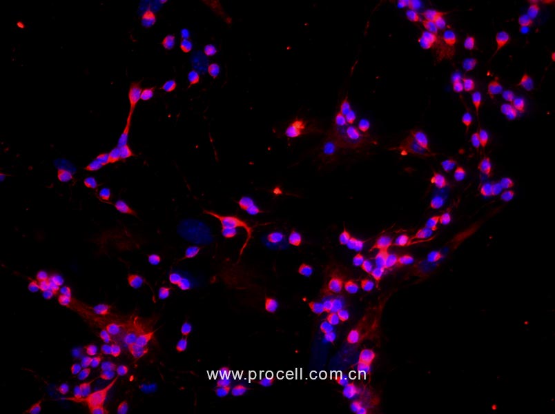 小鼠视网膜神经节细胞