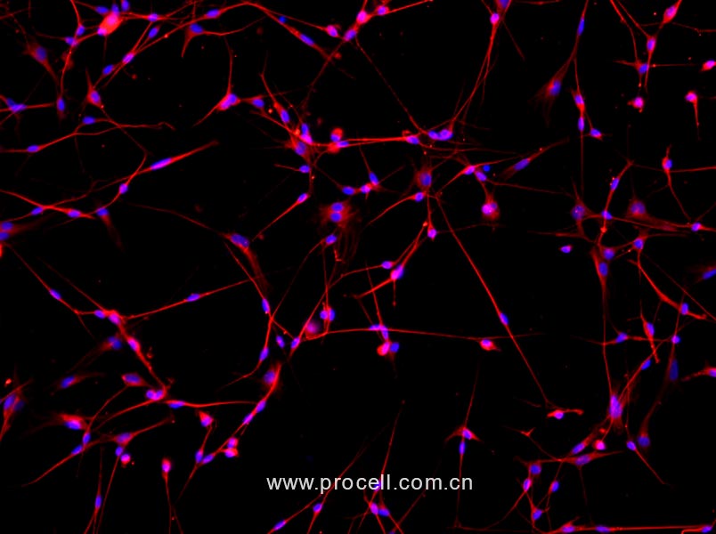 小鼠背根神经元细胞