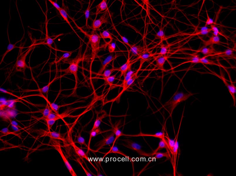 小鼠背根神经元细胞